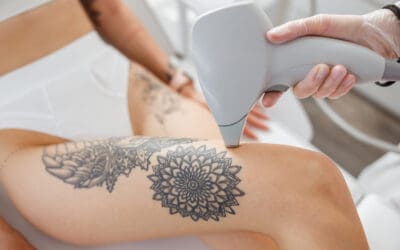 Say Goodbye To Stubble: Why Laser Hair Removal Is The Best Choice